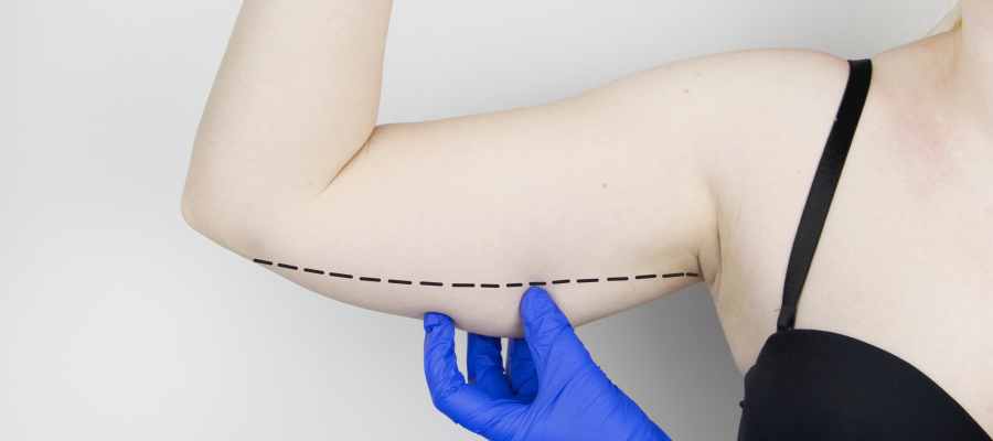 Arm Lift Surgery Specialist Near Me in Miami Beach, FL