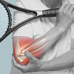 Lateral Epicondylitis Surgery Near Me in Miami Beach, FL