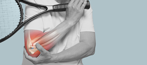 Lateral Epicondylitis (Tennis Elbow) Surgery Specialist Near Me in Miami Beach, FL