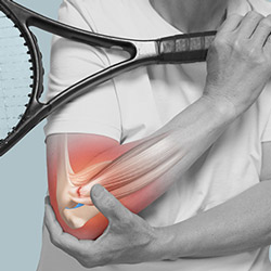 Lateral Epicondylitis Surgery Near Me in Miami Beach, FL