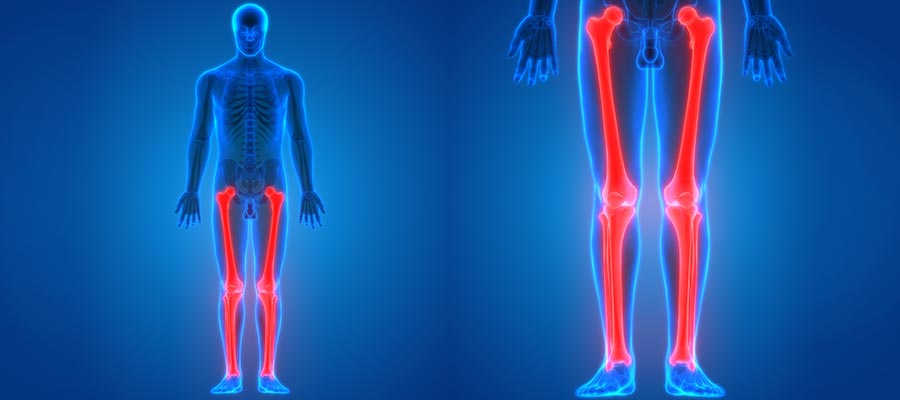 Limb Lengthening (Height Increase) Surgery Specialist Near Me in Miami Beach, FL
