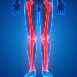 Limb Lengthening Surgery Near Me in Miami Beach, FL
