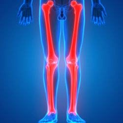 Limb Lengthening Surgery Near Me in Miami Beach, FL