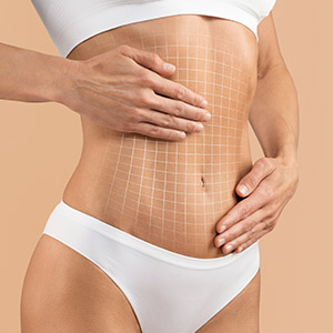 Liposuction Near Me in Miami Beach, FL