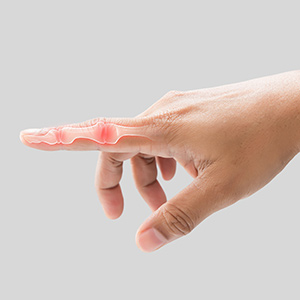 Trigger Finger Surgery Near Me in Miami Beach, FL