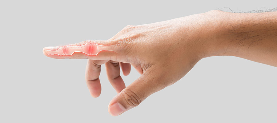 Trigger Finger Surgery Specialist Near Me in Miami Beach, FL