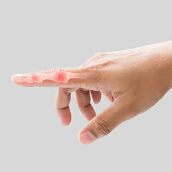 Trigger Finger Surgery Near Me in Miami Beach, FL