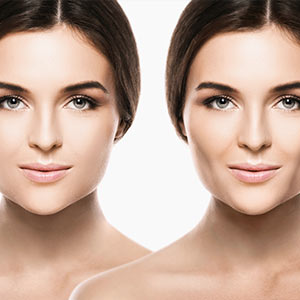 Buccal Fat Removal Near Me in Miami Beach, FL