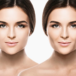 Buccal Fat Removal Near Me in Miami Beach, FL