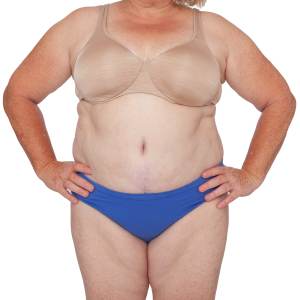 Mommy Makeover Specialist Near Me in Miami Beach, FL