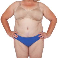 Mommy Makeover Specialist Near Me in Miami Beach, FL