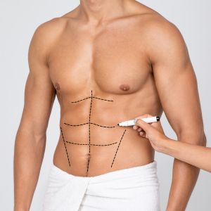 Male Abs (Spartan Abs) Specialist Near Me in Miami Beach, FL