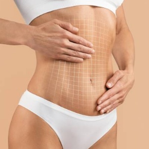 Tummy Tuck Near Me in Miami Beach, FL