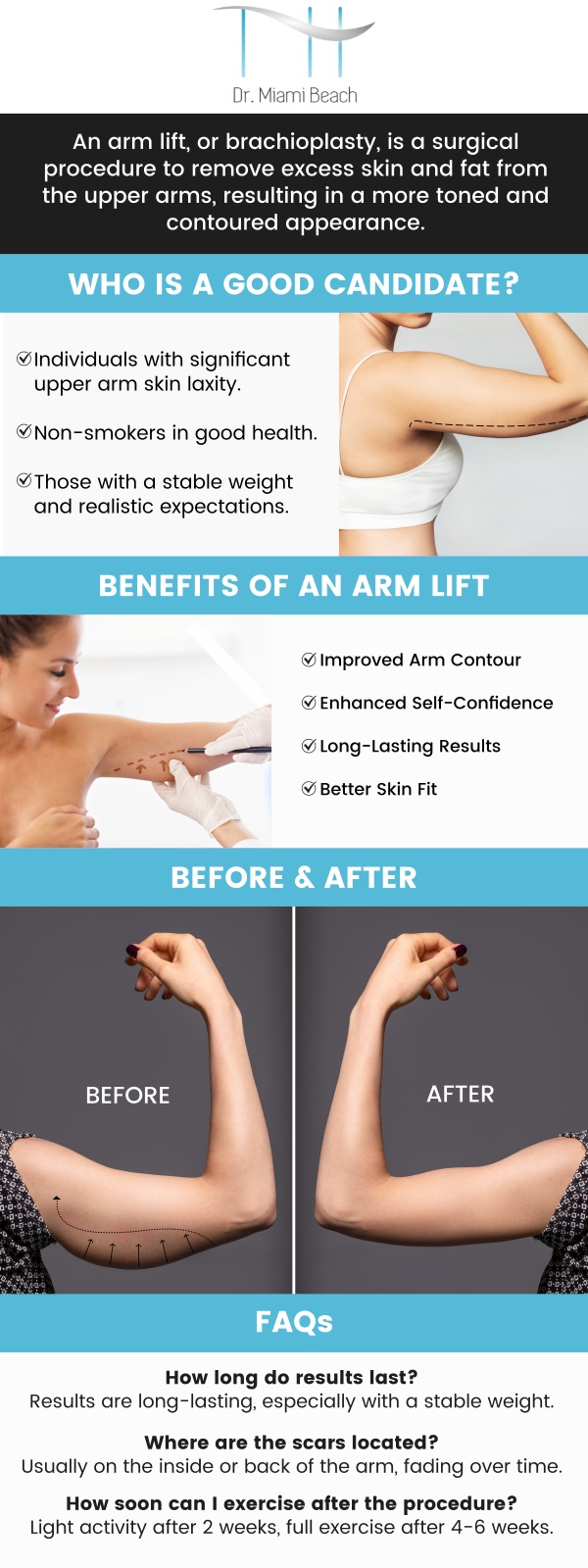 An arm lift, known as Brachioplasty, is an aesthetic procedure that restores the appearance of the upper arm by removing extra skin and fat and addressing sagging or loose skin caused by aging, weight loss, or genetic causes through an incision along the arm's inner or back. If you want to improve the appearance of your arms, consider arm lift surgery. Our amazing team of experts at Dr. Miami Beach provides arm lift surgery. For more information, contact us or schedule an appointment online. We are conveniently located at 400 W. 41St Street, Suite #412, Miami Beach, FL 33140.
