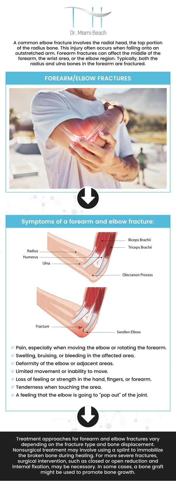 The symptoms of a forearm/elbow fracture include sudden acute pain, the inability to straighten the elbow, swelling and bruises near the elbow, tenderness to touch, and pain when moving the joint. Visit our professional team for elbow fracture treatment. For more information, please contact us or schedule an appointment online. We are conveniently located at 400 W. 41St Street, Suite #412, Miami Beach, FL 33140. We serve clients from Miami Beach FL, Miami FL, Brickell FL, Bay Harbor Islands FL, Coral Gables FL, Sunny Isles FL, Key Biscayne FL and surrounding areas.