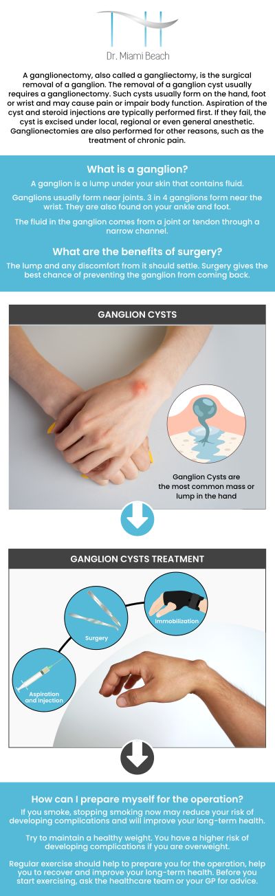 Common questions asked by patients: What is the main cause of ganglion cysts? What happens if a ganglion cyst is left untreated? How long does it take to recover from ganglion cyst removal surgery? Is ganglion cyst surgery painful? For more information, please contact us or schedule an appointment online. We are conveniently located at 400 W. 41St Street, Suite #412, Miami Beach, FL 33140. We serve clients from Miami FL, Brickell FL, Bay Harbor Islands FL, Coral Gables FL, Sunny Isles FL, Key Biscayne FL, and surrounding areas.
