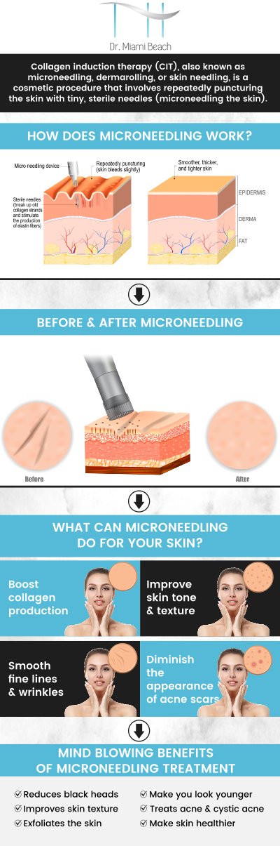Microneedling is an advanced cosmetic procedure that revitalizes your skin by stimulating collagen production, reducing fine lines, and improving texture. At Dr. Miami Beach, we specialize in microneedling treatments to help you achieve smoother, more youthful-looking skin. Our team is committed to delivering outstanding results while prioritizing your safety and satisfaction. For more information, contact us or schedule an appointment online. We are conveniently located at 400 W. 41St Street, Suite #412, Miami Beach, FL 33140.
