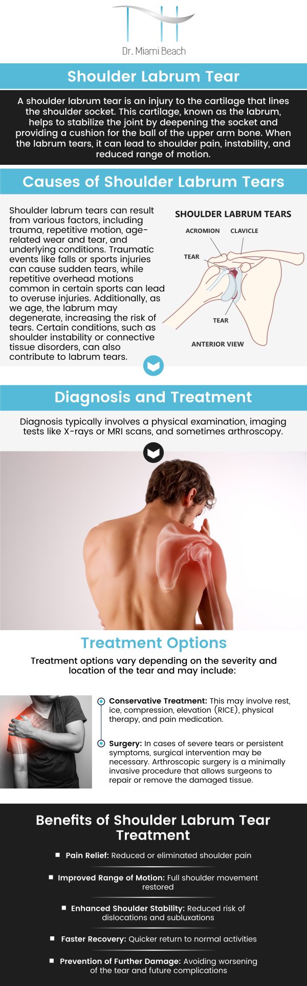Common questions asked by patients: Can a shoulder impingement cause a labral tear? Can you still use your shoulder with a torn labrum? How serious is a shoulder labrum tear? What is the difference between shoulder impingement and SLAP tear? For more information, please contact us or schedule an appointment online. We are conveniently located at 400 W. 41St Street, Suite #412, Miami Beach, FL 33140. We serve clients from Miami Beach FL, Miami FL, Brickell FL, Bay Harbor Islands FL, Coral Gables FL, Sunny Isles FL, Key Biscayne FL, and surrounding areas.
