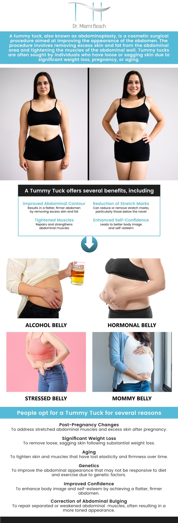 The tummy tuck, also known as abdominoplasty, is an aesthetic surgery that removes extra skin and tightens abdominal muscles to create a smoother, firmer, more toned waist. It improves appearance, comfort, and core strength, making it suitable for individuals with stable weight, healthy lifestyles, loose skin, and post-pregnancy diastasis recti. If you're interested in getting a tummy tuck and want to have a more contoured and toned midsection, our team of aestheticians at Dr. Miami Beach provides consultations to discuss your goals and evaluate if this treatment is suitable for you. For more information, contact us or schedule an appointment online. We are conveniently located at 400 W. 41St Street, Suite #412, Miami Beach, FL 33140.