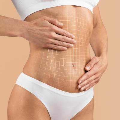 Tummy Tuck Near Me in Miami Beach, FL