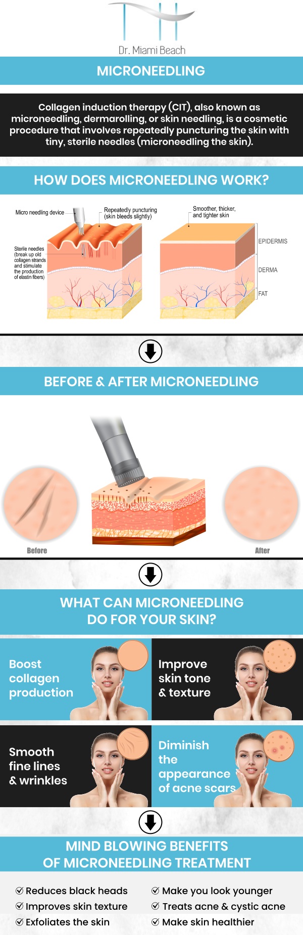 Microneedling is an effective treatment for reducing acne scars. It helps improve skin texture and tone. This non-invasive procedure promotes smoother, clearer skin, making it a great option for those looking to enhance their complexion. Visit the experienced aestheticians at Dr. Miami Beach to achieve a more even skin surface. For more information, please contact us or schedule an appointment online. We are conveniently located at 400 W. 41St Street, Suite #412, Miami Beach, FL 33140.