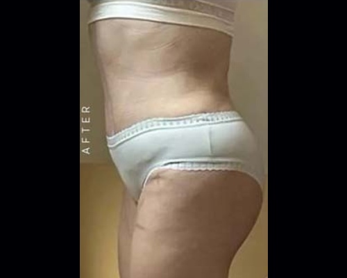 After